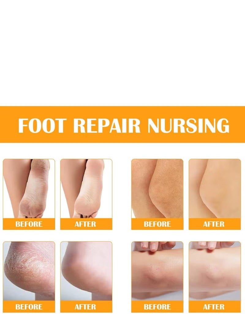 Elaimei Fashion Base Foot Spray Foot Peel Spray Quickly Callus Removal 100mL Foot Peeling Spray for Cracked Foot Dead Skin Foot Care (Orange 100mL) - Image 5