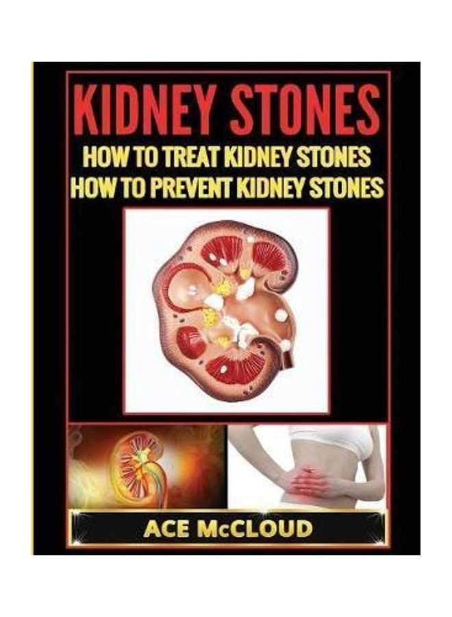Kidney Stones: How To Treat Kidney Stones: How To Prevent Kidney Stones - Image 2