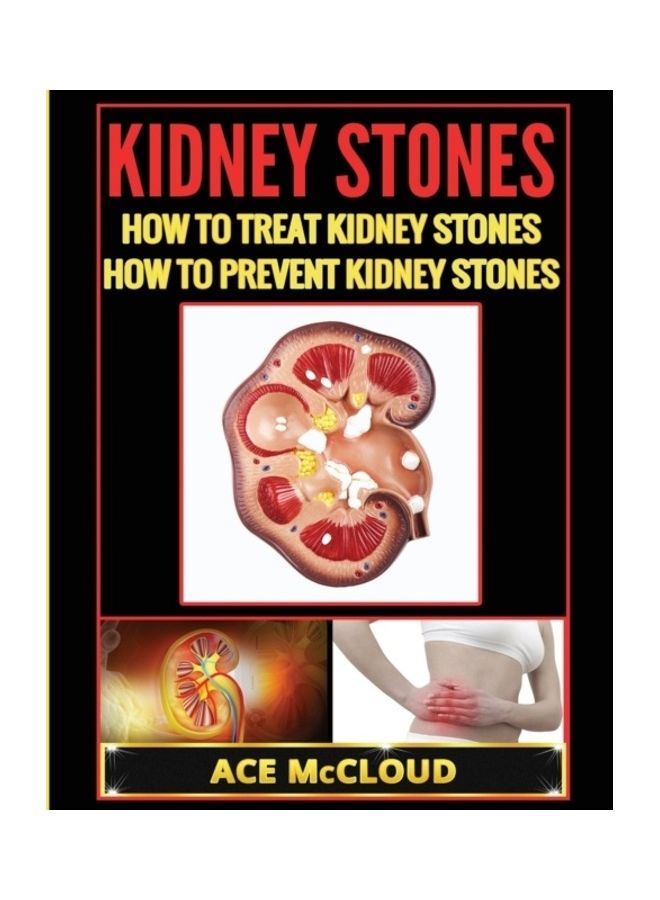 Kidney Stones: How To Treat Kidney Stones: How To Prevent Kidney Stones - Image 3