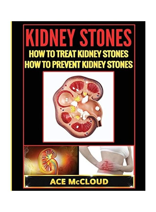 Kidney Stones: How To Treat Kidney Stones: How To Prevent Kidney Stones - Image 1