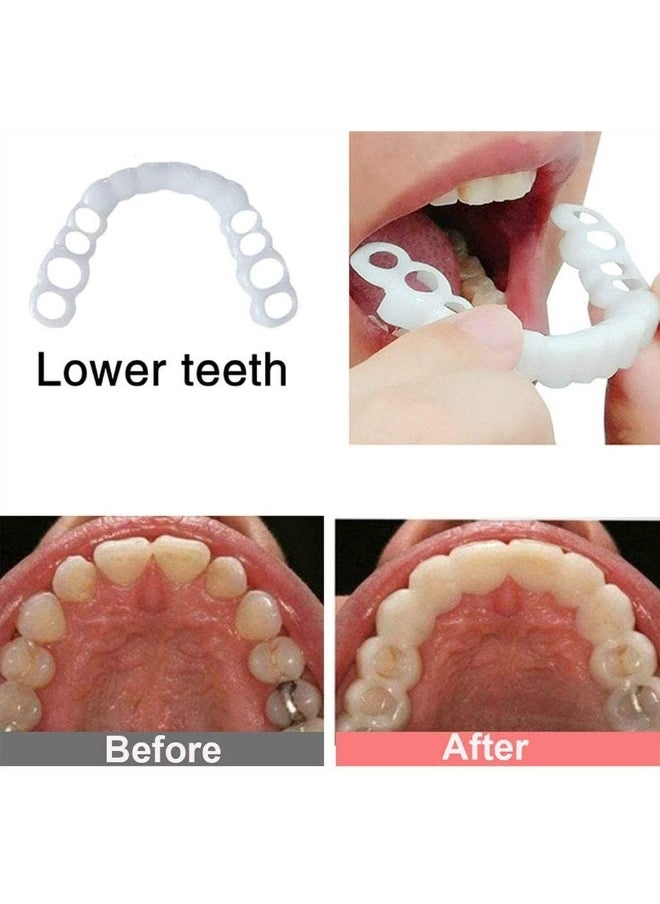Generic Snap On Smile - Instant Perfect Smile Clip On Veneers (Work for Top Or Bottom) - Perfect Braces and Whitening Alternative No Pain No Shots No Drilling - Perfect Smile in Minutes  - Image 2