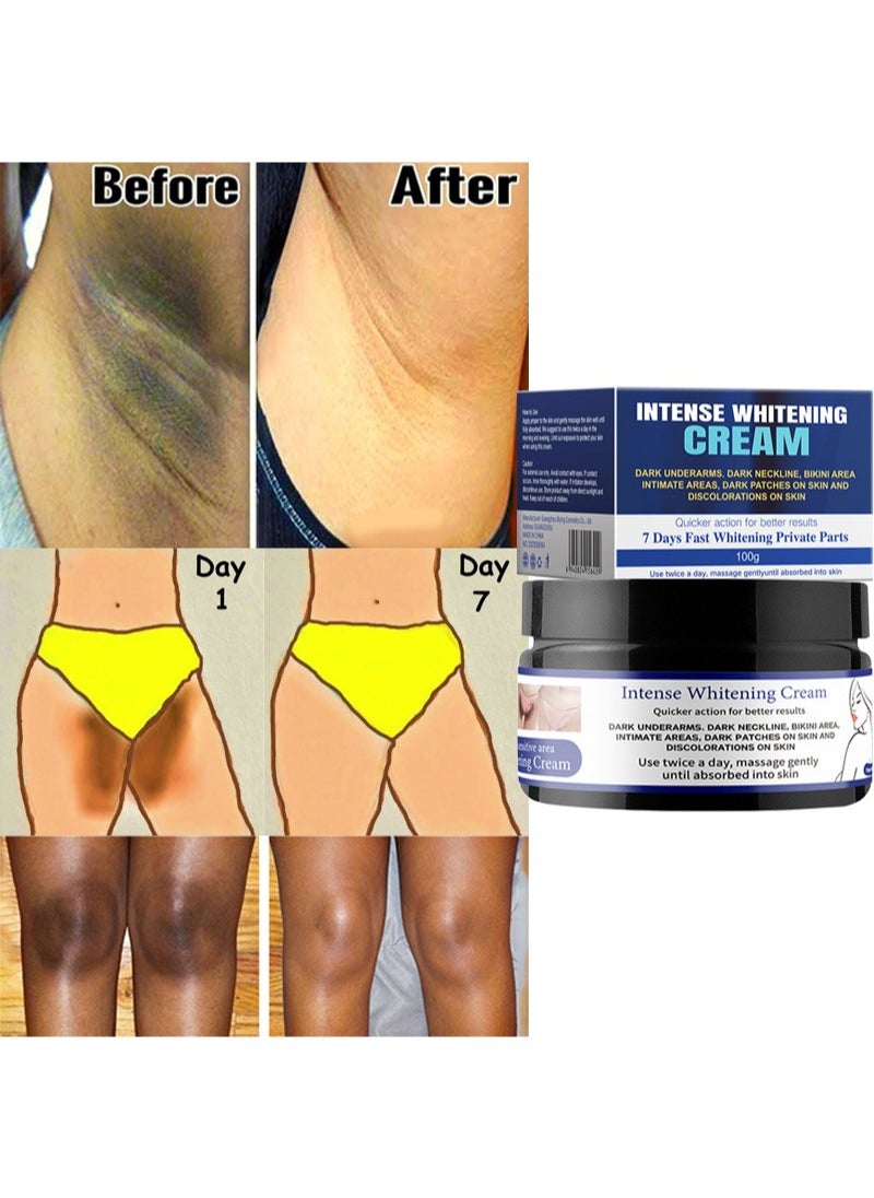 MOOYAM - Intimate Skin Cream - Dark Spot Corrector Cream-Underarm Cream for Armpit, Neck, Knees, Elbows, Inner Thigh, Private Parts - Formulated with Hyaluronic Acid, Niacinamide and Centella-100 ml - Image 1