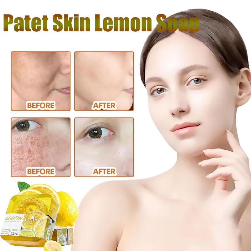 Cappuvini Patet Skin Soap Patetskin Bright Even Lemon Soap Bar Patet Skin Essential Oil Soap Bars Patet Skin Soap Bar Patet Skin Care Soap Lemon Acid Soap for Hyperpigmentation Dark Spots Aloe - Image 2