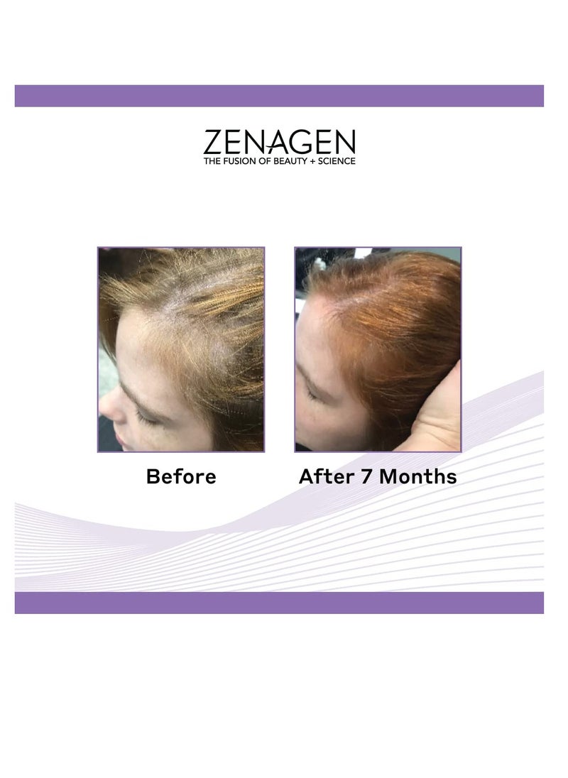 Zenagen Zenagen Revolve Thickening and Hair Loss Shampoo Treatment for Women  - Image 3