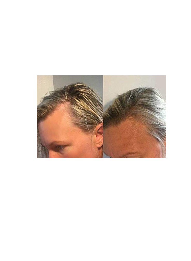 Zenagen Zenagen Revolve Thickening and Hair Loss Shampoo Treatment for Women  - Image 4