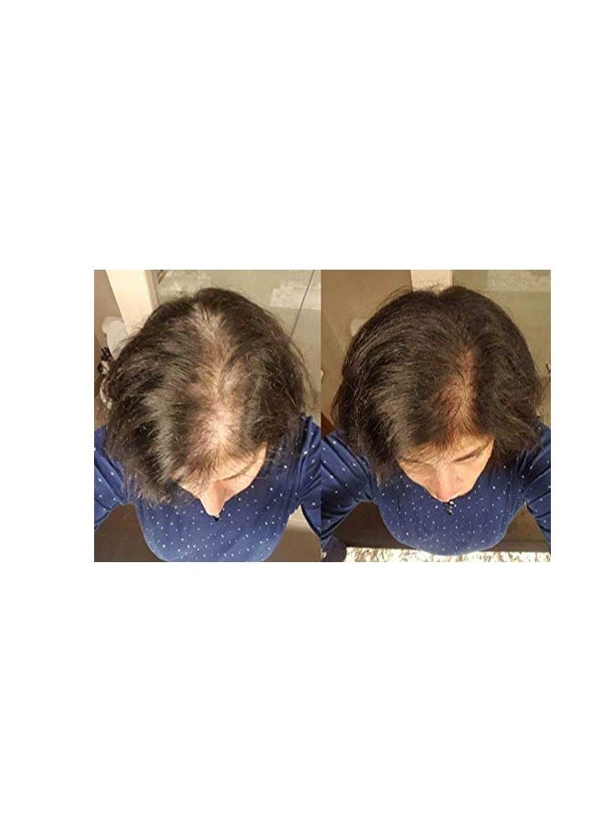 Zenagen Zenagen Revolve Thickening and Hair Loss Shampoo Treatment for Women  - Image 2