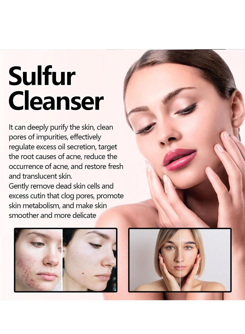 إيلهو منظف الوجه بالكبريت الطبيعي ، منظف تقشير للوجه ، يهدئ ويبرد الاحمرار وعدم الراحة ، يقلل من الزيوت الزائدة عن البثور ، ينظف بلطف ، ينعش ويجعل البشرة متألقة 100 جرام - Image 4