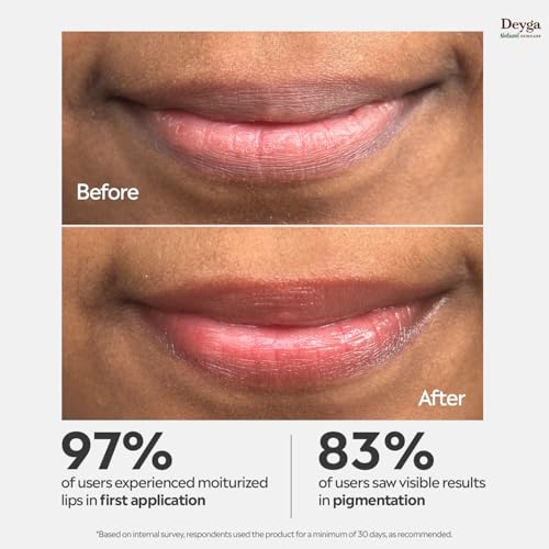 Deyga Beetroot Lip Balm | Tinted Lip Care | For Dry & Chapped Lips | For Pigmented Lips | For Women & Men (Pack of 1, Stick Lip Balm), Red - Image 2