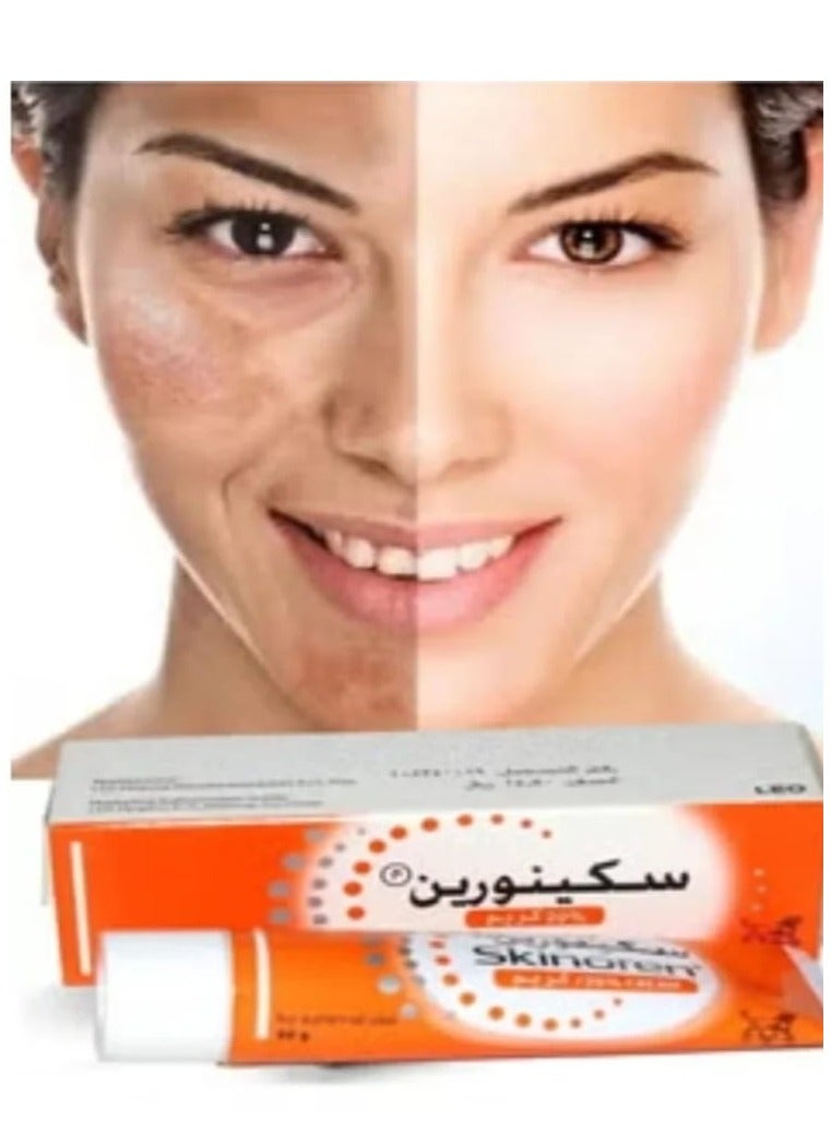 Skinoren Acne Treatment Cream