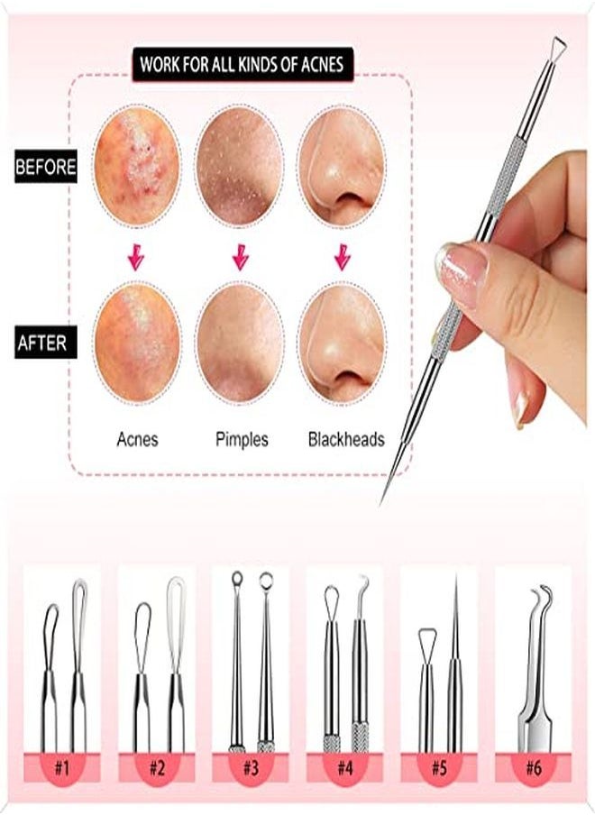 Cbiumpro - Blackhead Remover Pimple Popper Tool Kit, 6 Pack Professional Comedones Extractor Acne Removal Kit For Blemishs, Whitehead Popping, Zit Removing For Nose Face - With Organized Case - Image 1