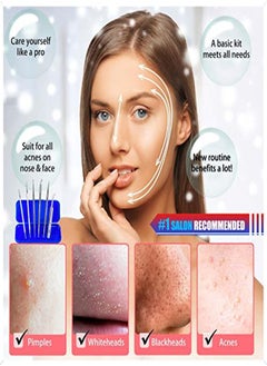 Cbiumpro Blackhead Remover Pimple Popper Tool Kit, 6 Pack Professional Comedones Extractor Acne Removal Kit For Blemishs, Whitehead Popping, Zit Removing For Nose Face - With Organized Case  - Image 3