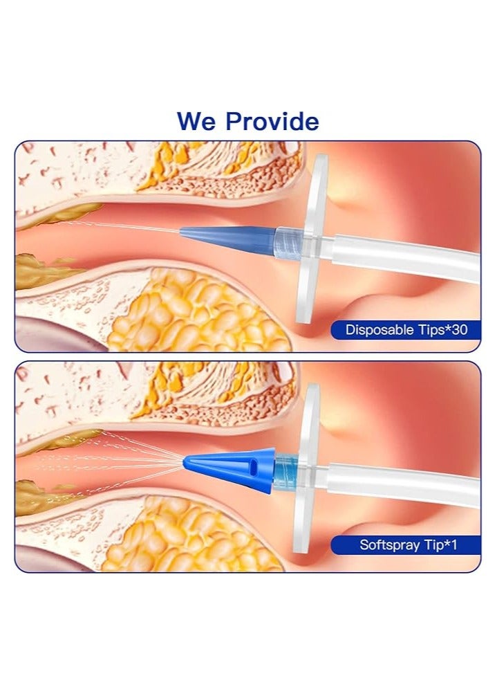 general Earwax Removal Tools Manual Ear Rinse Cleaning System Ear Cleaning Wash Kit Safe and effective ear cleaners for adults and children - Image 4
