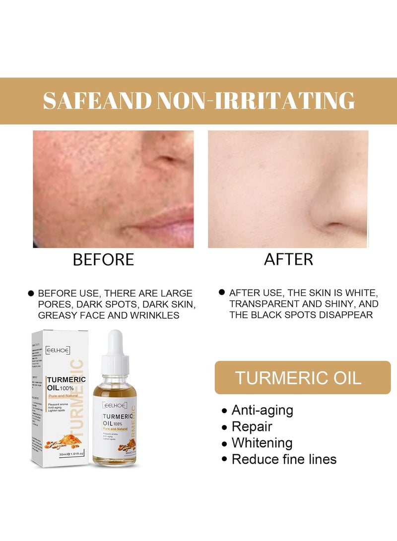 EELHOE سيروم تصحيح البقع الداكنة بالكركم، سيروم إصلاح الوجه الطبيعي بالكركم، جوهر ترطيب الوجه، سيروم تبييض الوجه لتصحيح البقع الداكنة للبشرة المتألقة - Image 3