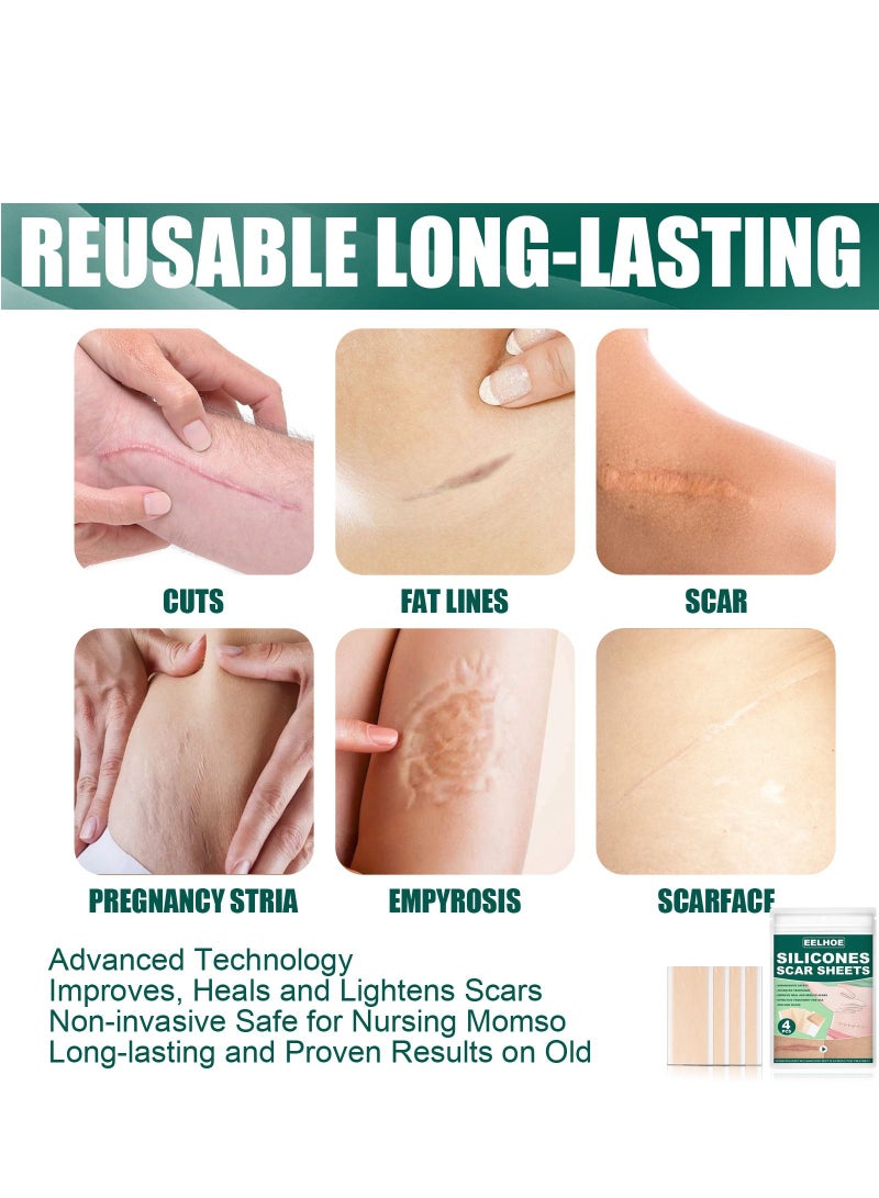 إيلهو ملصق ندبة من السيليكون ملصق ندبة حرق ملصق إصلاح الجرح الجلدي 4 * 7.5 سم - Image 5