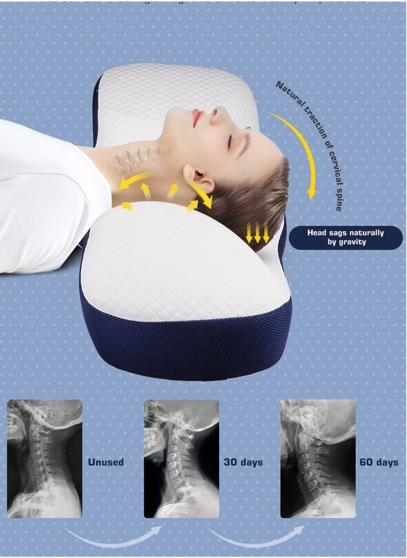 Snooe - سومكايل وسادة رغاوي الذاكرة للنوموسادة عنق الرحم لوسادة دعم الرقبة والكتف للنائمين الجانبي البوليستر الأبيض - Image 1
