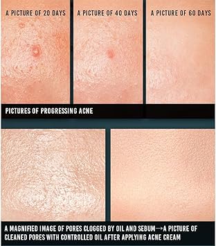 PYUNKANG YUL Acne Cream 50ml - Image 5