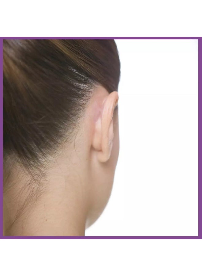 Otostick Cosmetic Ear Correctors - Image 4