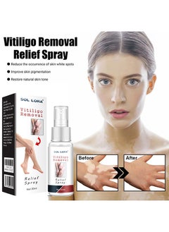 SOL LORA SOL LORA White Spot Cleansing Spray, Psoralea corylifolia White Spot Cleansing Spray Skin Repair Spot Liquid Care  - Image 2