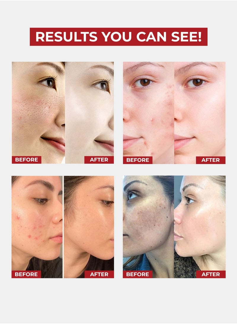 Yusma Beauty Cream - Helps get Acne Free Glowing Skin, Even Skin Tone, Brightens - For All Skin Types 30g  - Image 2