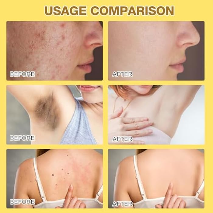 Grenben Bee Venom Skin Treatment Cream, Professional Bee Venom Correcting Cream for All Skin Types (2PCS) - Image 4