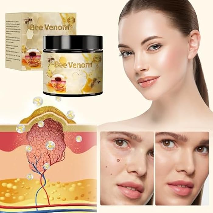Grenben Bee Venom Skin Treatment Cream, Professional Bee Venom Correcting Cream for All Skin Types (2PCS) - Image 3