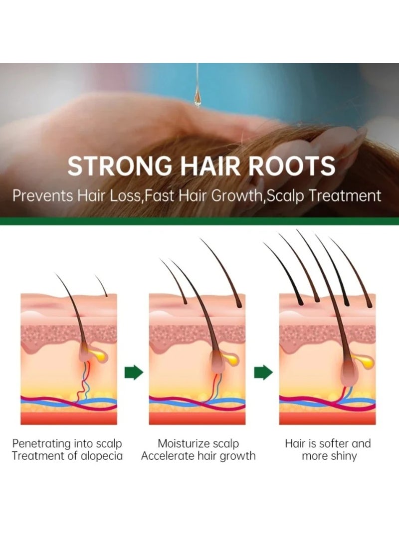 EELHOE محلول تغذية الشعر بالزنجبيل الطبيعي، مصل إعادة نمو الشعر، سائل تساقط الشعر مع خلاصة الزنجبيل والجينسنغ لتقوية الشعر الخفيف وجذور الشعر - Image 4