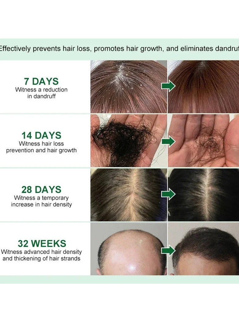 EELHOE محلول تغذية الشعر بالزنجبيل الطبيعي، مصل إعادة نمو الشعر، سائل تساقط الشعر مع خلاصة الزنجبيل والجينسنغ لتقوية الشعر الخفيف وجذور الشعر - Image 3