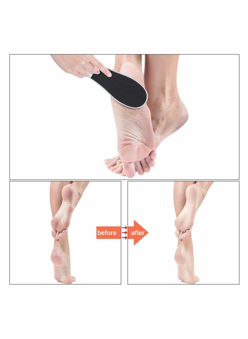 Y&D 4 Pack Double Sided Foot File Dead Skin Remover Hard  - Image 4