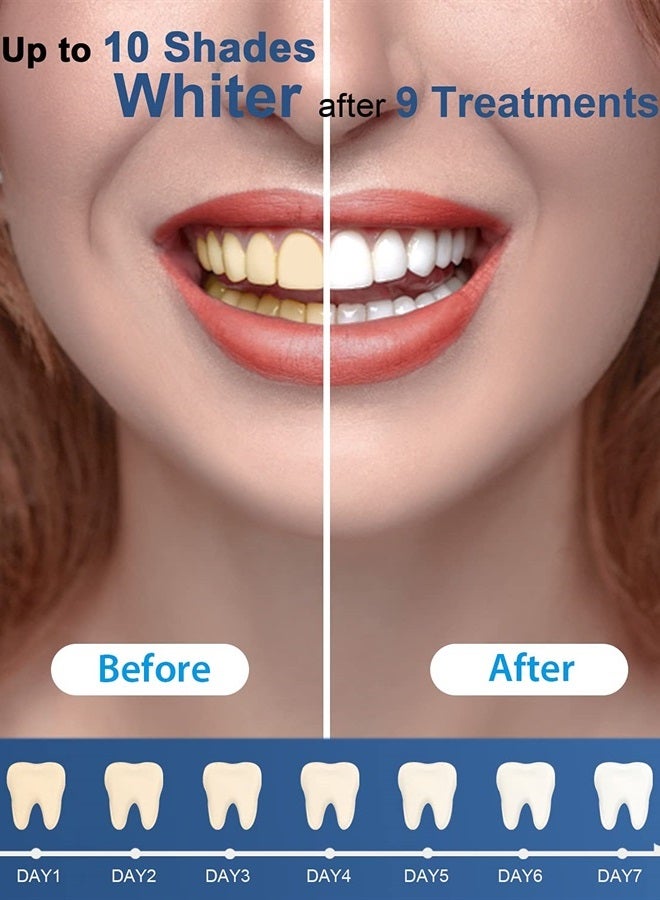 MySmile Teeth Whitening Gel Pen Refill Pack, 3 Non-Sensitive Teeth Whitening Pen, Deluxe Teeth Whitener Dental Grade Tooth Whitening Gel with Carbamide Peroxide for Home, 10 min Fast Result - Image 5