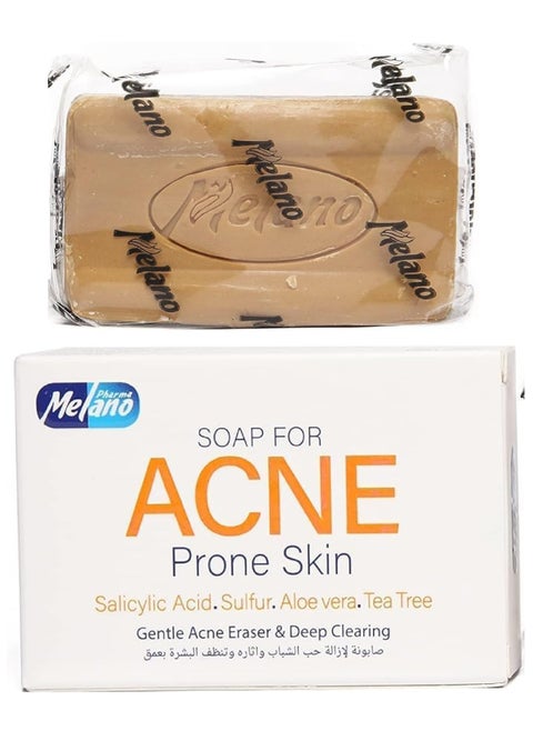 Soap For Acne Prone Skin 100 g