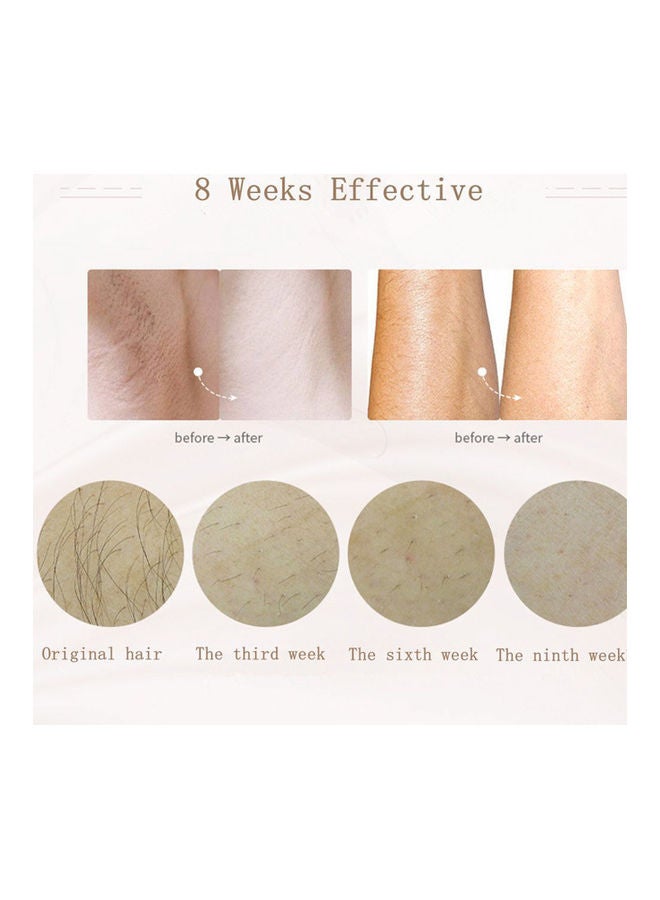 MLAY Permanent Laser Hair Removal Device - Image 5