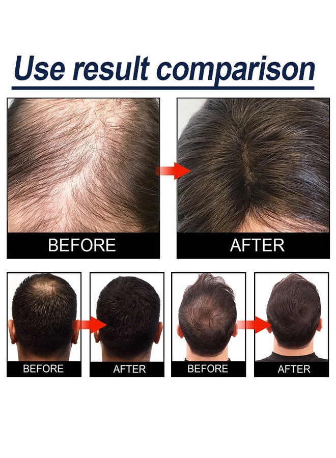 ERAYCEE Anti-hair Loss Spray, Hair Regrowth Spray-Anti Hair Loss Serum，Ginseng and Ginger Hair Growth Booster Serum, Regrowth Spray and Essential Oils - Anti Hair Loss Treatment for Optimal Hair Care 30ml - Image 4