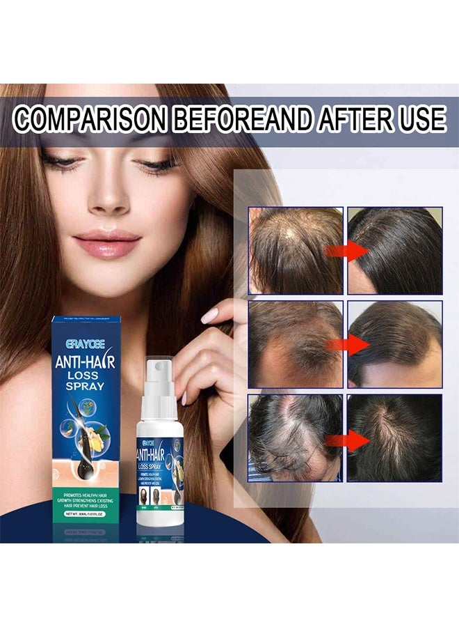 ERAYCEE Anti-hair Loss Spray, Hair Regrowth Spray-Anti Hair Loss Serum，Ginseng and Ginger Hair Growth Booster Serum, Regrowth Spray and Essential Oils - Anti Hair Loss Treatment for Optimal Hair Care 30ml - Image 5