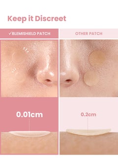 Glam Up Hydrocolloid Blemish Pimple Zit Patches - Invisible Ultra Thin Spot Cover Stickers for Face and Skin, Strong Water-proof and Adhesive Overnight, Vegan-friendly (36 Count / 2 Sizes)  - Image 4