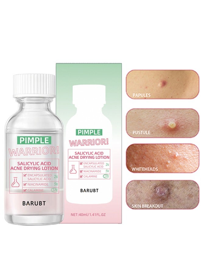 BARUBT Salicylic Acid Acne Drying Lotion-Acne Repair,Promotes Acne Removal,For All Skin Types - Image 1