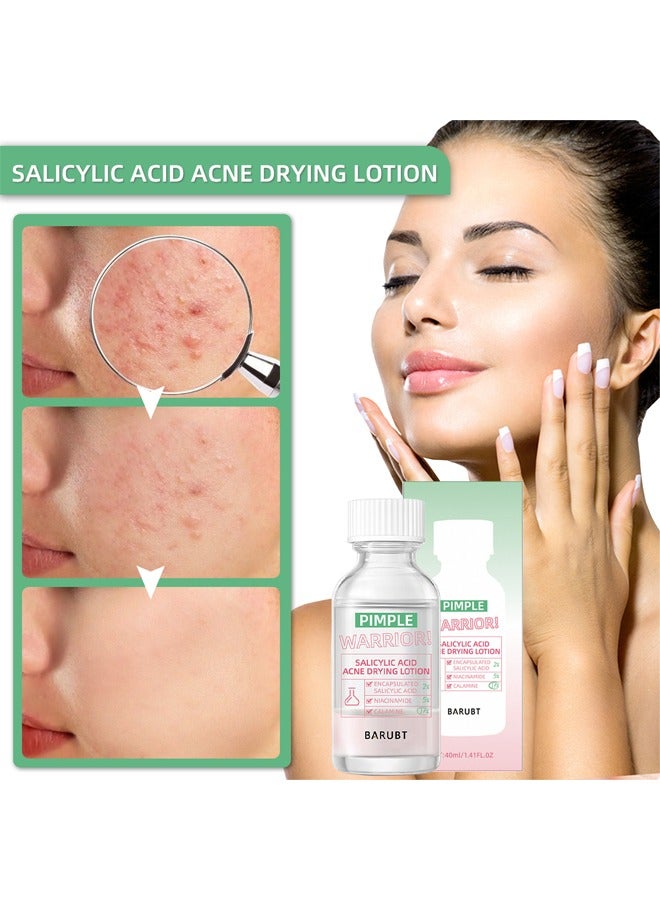 BARUBT Salicylic Acid Acne Drying Lotion-Acne Repair,Promotes Acne Removal,For All Skin Types - Image 3
