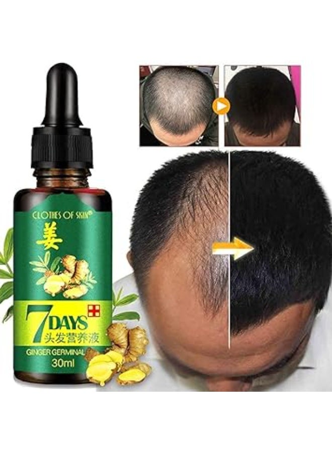 ايتشون زيت الزنجبيل العطري من هير ريجرو 7 دايز، زيت الزنجبيل العطري لعلاج تساقط الشعر والعناية بالشعر للرجال والنساء، 30 مل (عبوة واحدة) - Image 4