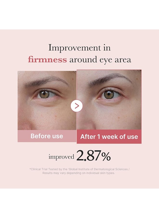 FILMFISH - Niacinamide Multi-Effect Eye Cream 30g | Dark Circles, Eye Bags, Fine Lines, Hydrating & Brightening - Image 1