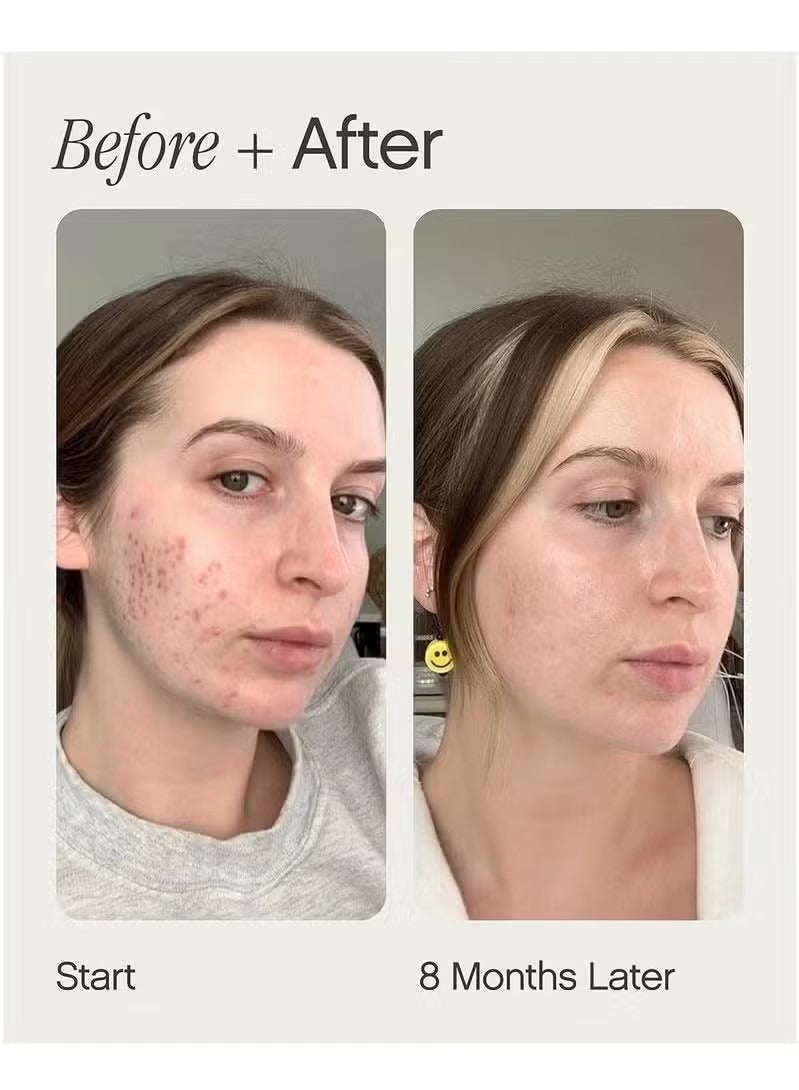 TOPICALS Faded Brightening and Clearing Serum | Reduces Discoloration Post-Blemish Marks Scars Spots Contains Kojic Acid Niacinamide Dermatologist-tested Vegan Cruelty-Free Fl Oz - Image 3