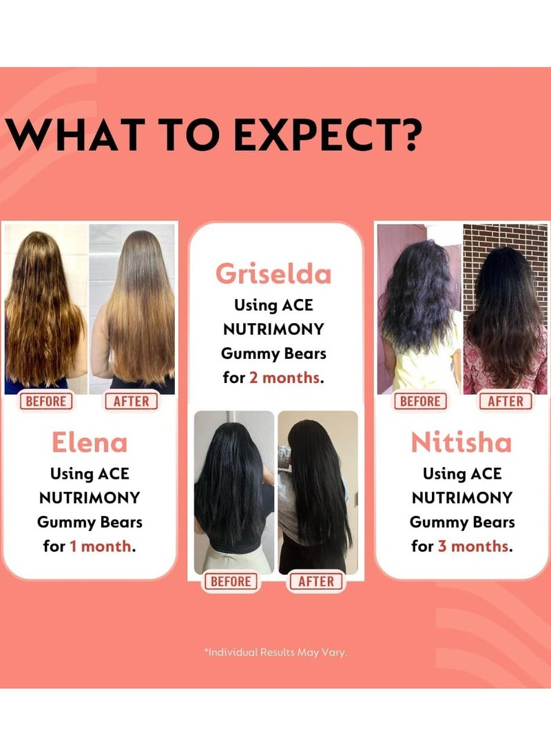 Ace Nutrimony Biotin Gummies For Hair Skin And Nails With Clinically Proven Ingredient Keranat, Supplement for Hair Growth & Hair Fall Control - 60 Gummy Bear  - Image 3