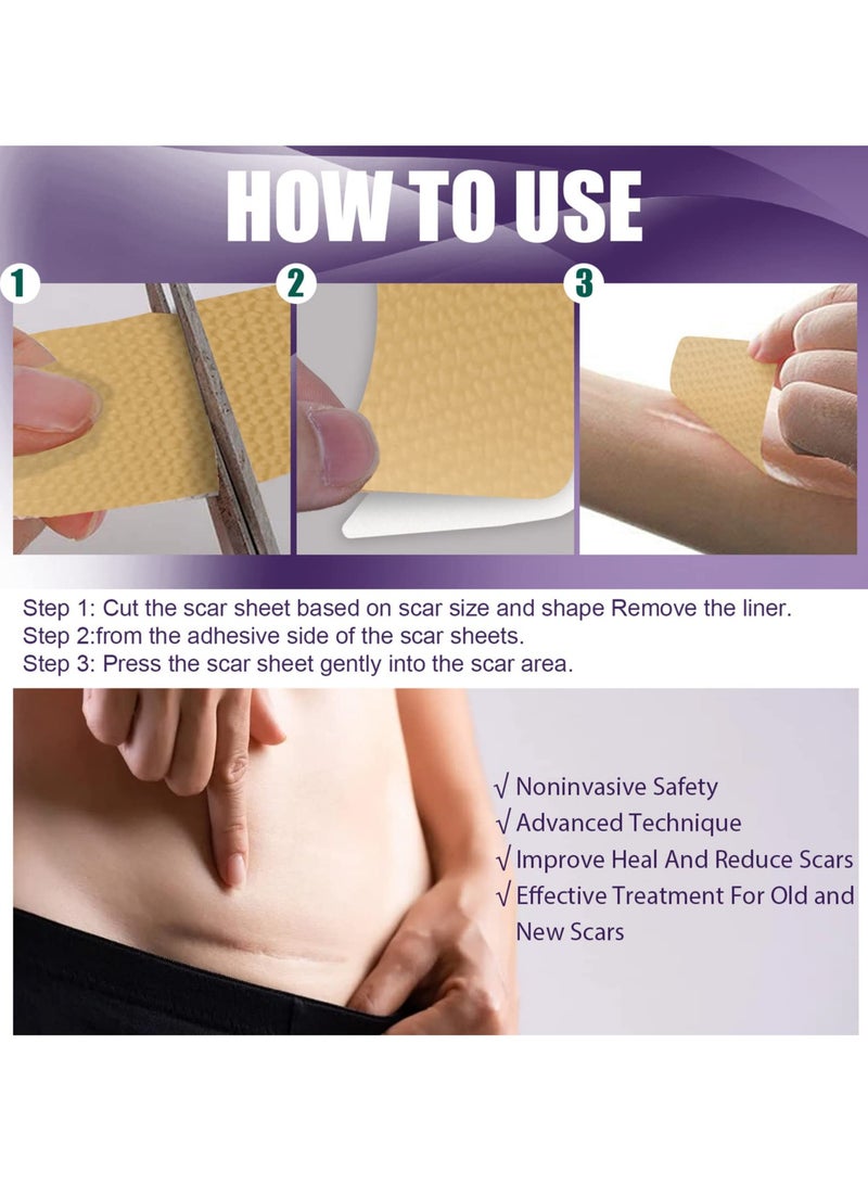 SYOSI Silicone Scar Sheets, Professional Silicone Scar Tape, Silicone Gel for Scars, Silicone Scar Strips, Soft Scar Sheets for Acne, Keloid, Burns, Acne, C-Section Surgical Scar - Image 4