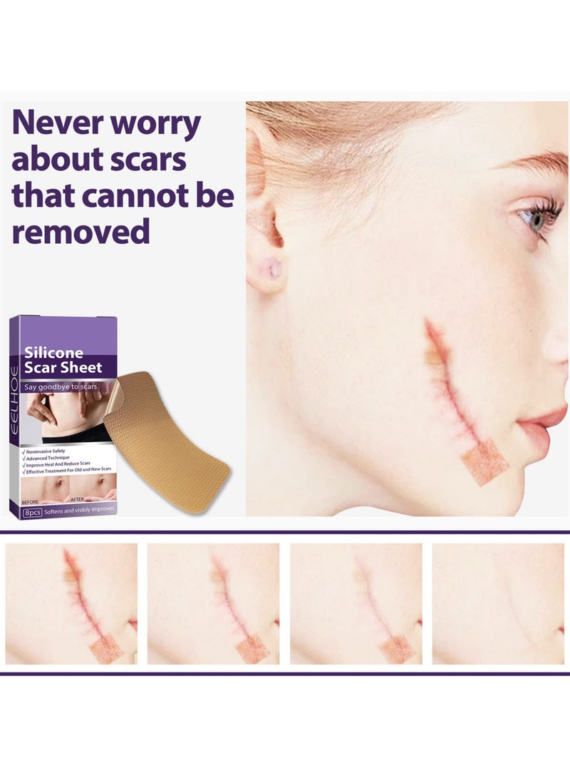 SYOSI Silicone Scar Sheets, Professional Silicone Scar Tape, Silicone Gel for Scars, Silicone Scar Strips, Soft Scar Sheets for Acne, Keloid, Burns, Acne, C-Section Surgical Scar - Image 2