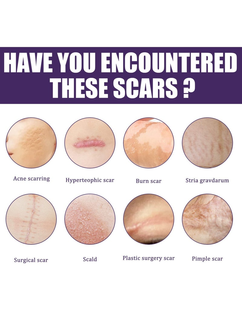 SYOSI Silicone Scar Sheets, Professional Silicone Scar Tape, Silicone Gel for Scars, Silicone Scar Strips, Soft Scar Sheets for Acne, Keloid, Burns, Acne, C-Section Surgical Scar - Image 5