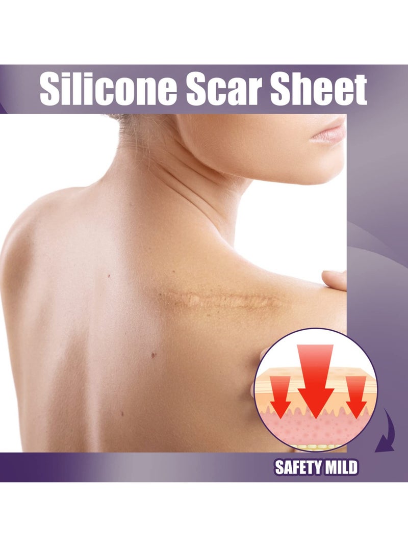 SYOSI Silicone Scar Sheets, Professional Silicone Scar Tape, Silicone Gel for Scars, Silicone Scar Strips, Soft Scar Sheets for Acne, Keloid, Burns, Acne, C-Section Surgical Scar - Image 3