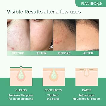 Plantifique Korean Skincare Face Mask Organic Clay Mask with Avocado Green Tea Vegan Dermatologically Tested Mud Mask for Face Body 100g34 Oz - Image 2