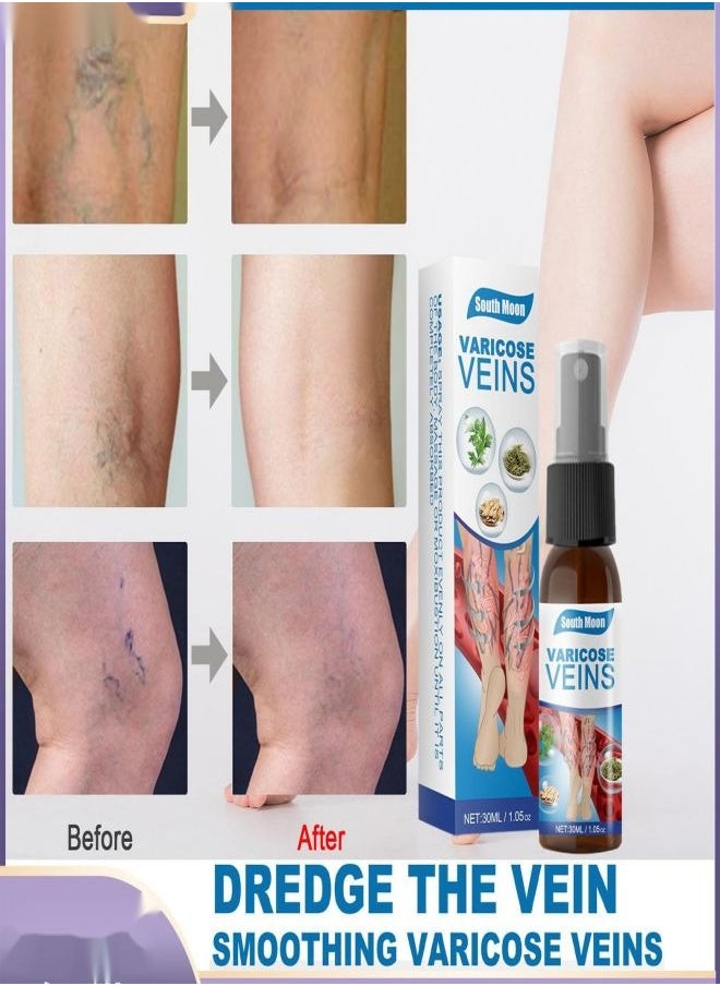 SOUTH MOON - Treatment of varicose veins spray, vein healing spray. - Image 1