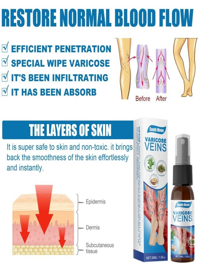 SOUTH MOON - Treatment of varicose veins spray, vein healing spray. - Image 1