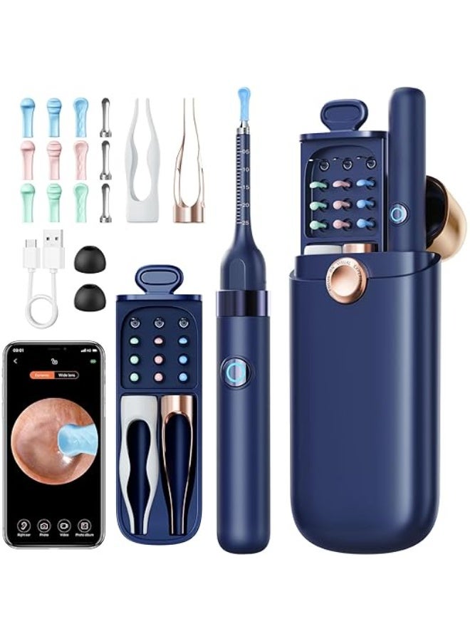 أداة تنظيف الأذن الذكية المرئية، أداة تنظيف الأذن المنزلية اللاسلكية فائقة الوضوح، أداة تنظيف الأذن المضيئة، متعددة الوظائف (أزرق). - Image 1