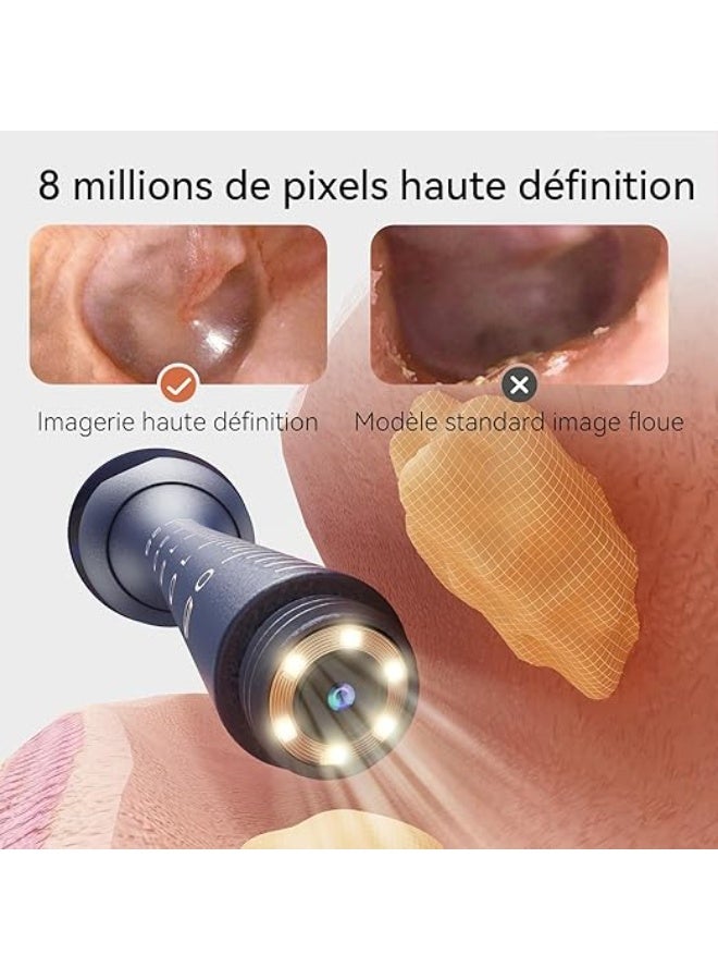 أداة تنظيف الأذن الذكية المرئية، أداة تنظيف الأذن المنزلية اللاسلكية فائقة الوضوح، أداة تنظيف الأذن المضيئة، متعددة الوظائف (أزرق). - Image 2