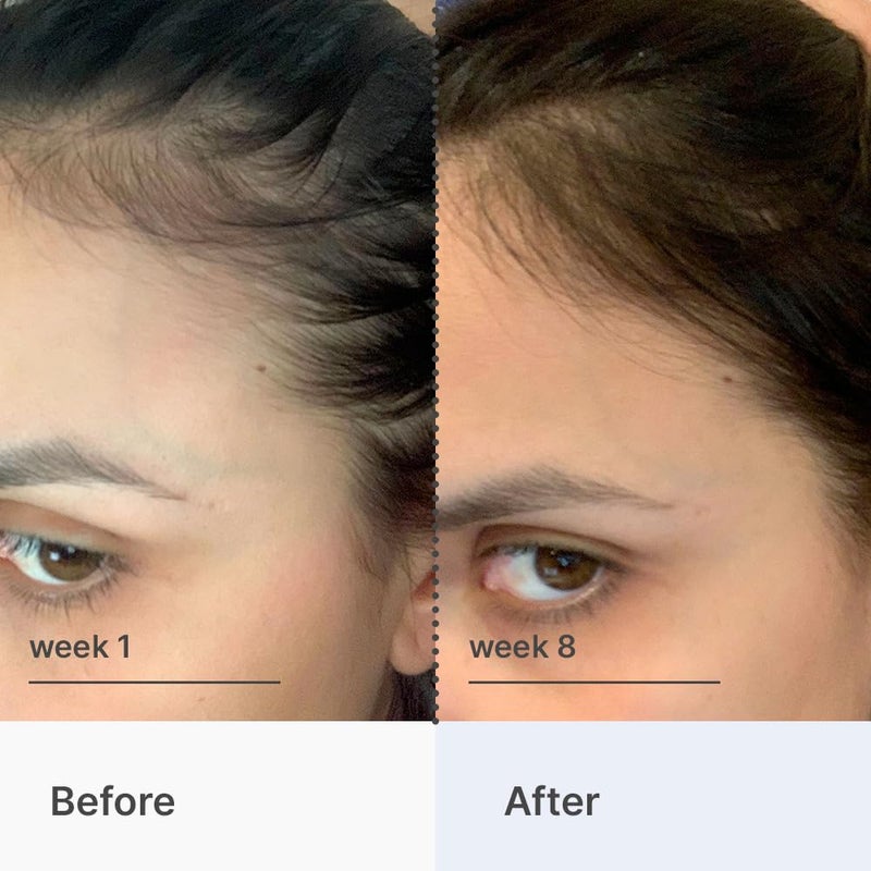 Better Not Younger Hair Thickening Serum for Women Over 40 â€“ Scalp Care, Hair Density Treatment and Anti-Aging 2fl.oz â€“ Fortifying Serum with Biotin & Ginger. Promotes Stronger, Thicker-Looking Hair. - Image 4